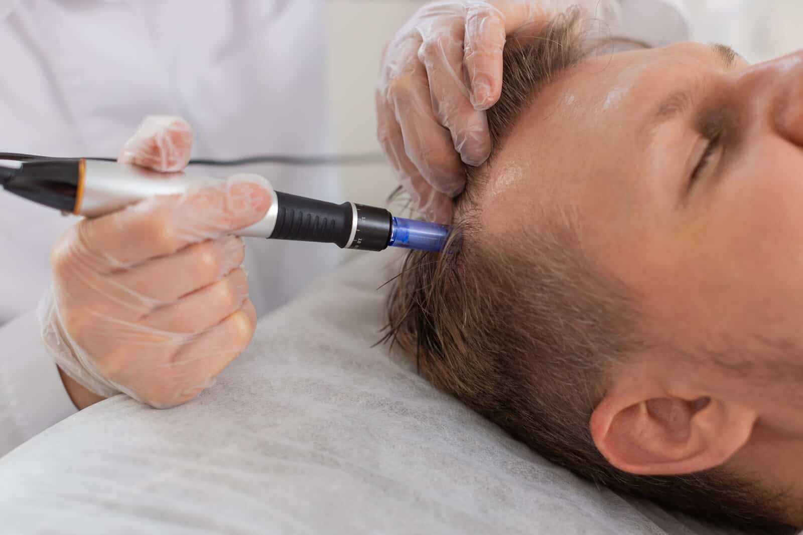 A male guest undergoes IV exosome therapy, administered to his scalp by a doctor