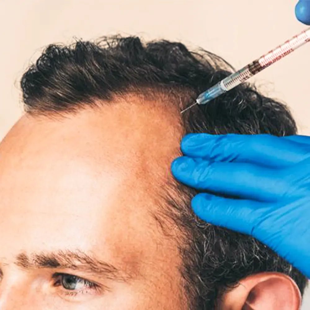 幹細胞ヘアセラピー - バンコクの高度発毛 - Healthi - Life Longevity Center