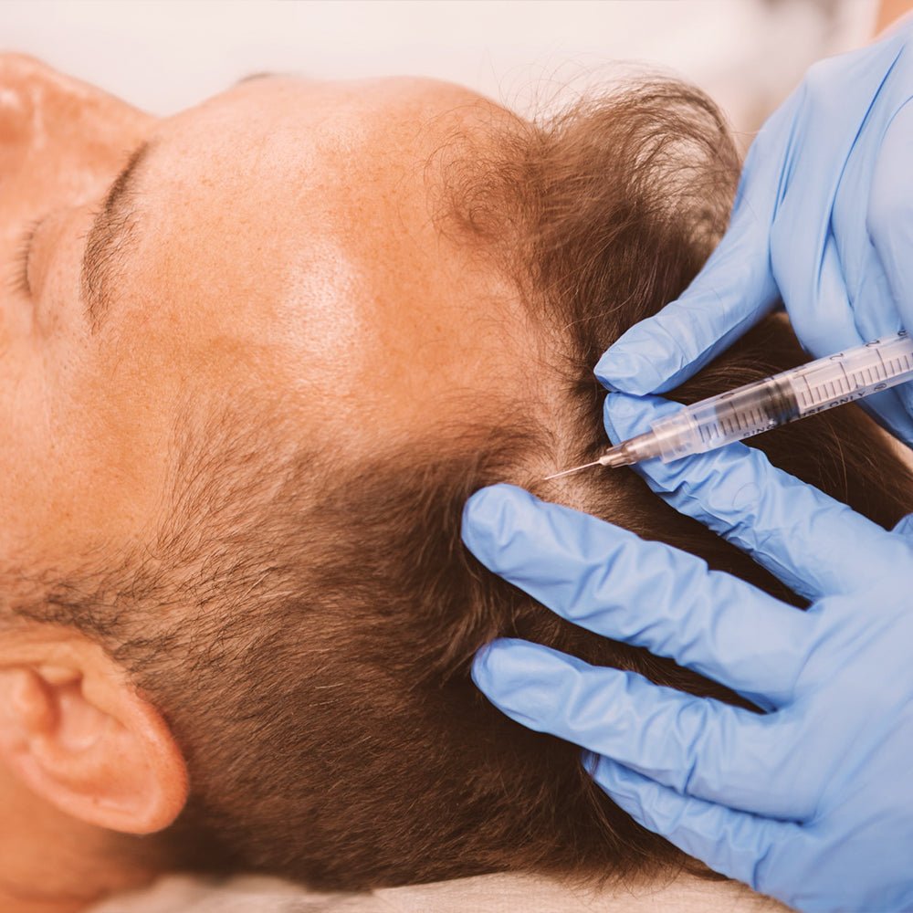 Мезотерапия для питания волос - Healthi - Центр долголетия жизни